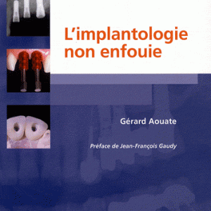 Implantologie non enfouie